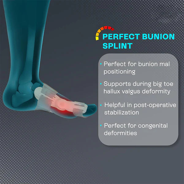 Bunion Support Splint. Valgus And Bunion Valgus Corrector Hallux Valgus Corrector Adjustable Bunion Valgus Protective Cover For Men And Women - 12738